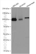 AP2A1 Antibody in Western Blot (WB)