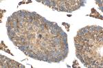 MEI4 Antibody in Immunohistochemistry (Paraffin) (IHC (P))