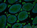 MEI4 Antibody in Immunohistochemistry (PFA fixed) (IHC (PFA))