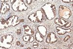 HMGA1 Antibody in Immunohistochemistry (Paraffin) (IHC (P))