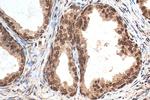 HMGA1 Antibody in Immunohistochemistry (Paraffin) (IHC (P))