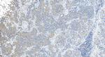 IFIT1 Antibody in Immunohistochemistry (Paraffin) (IHC (P))