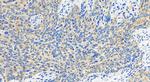IFIT1 Antibody in Immunohistochemistry (Paraffin) (IHC (P))