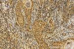 NFIB Antibody in Immunohistochemistry (Paraffin) (IHC (P))