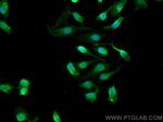 CRELD1 Antibody in Immunocytochemistry (ICC/IF)