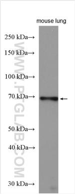 CRELD1 Antibody in Western Blot (WB)