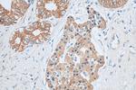 GALR2 Antibody in Immunohistochemistry (Paraffin) (IHC (P))