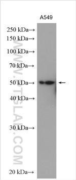 OTUD1 Antibody in Western Blot (WB)