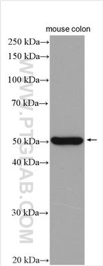 OTUD1 Antibody in Western Blot (WB)