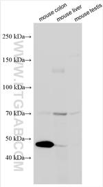 OTUD1 Antibody in Western Blot (WB)