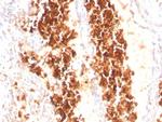 Glycophorin A/CD235a (Erythrocyte Marker) Antibody in Immunohistochemistry (Paraffin) (IHC (P))