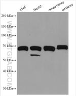 SPATS2L Antibody in Western Blot (WB)