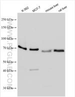 RIPK1 Antibody in Western Blot (WB)