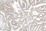 NCAPG Antibody in Immunohistochemistry (Paraffin) (IHC (P))