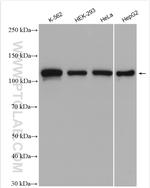 NCAPG Antibody in Western Blot (WB)