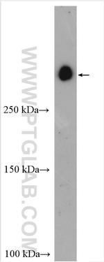 GPR179 Antibody in Western Blot (WB)
