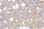 NETO1 Antibody in Immunohistochemistry (Paraffin) (IHC (P))