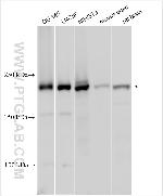 DOCK5 Antibody in Western Blot (WB)