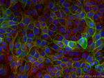 DSG3 Antibody in Immunocytochemistry (ICC/IF)