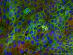 DSG3 Antibody in Immunocytochemistry (ICC/IF)