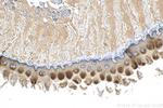 DSG3 Antibody in Immunohistochemistry (Paraffin) (IHC (P))