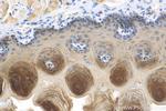 DSG3 Antibody in Immunohistochemistry (Paraffin) (IHC (P))