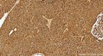 DSG3 Antibody in Immunohistochemistry (Paraffin) (IHC (P))