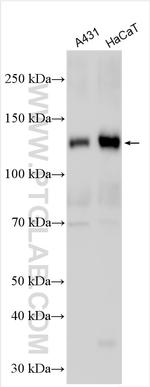 DSG3 Antibody in Western Blot (WB)