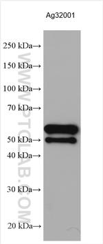 T7 RNA polymerase Antibody in Western Blot (WB)