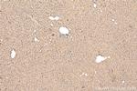 MYD88 Antibody in Immunohistochemistry (Paraffin) (IHC (P))