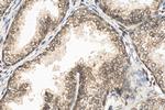 NCOR2 Antibody in Immunohistochemistry (Paraffin) (IHC (P))