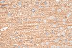 TrkB Antibody in Immunohistochemistry (Paraffin) (IHC (P))