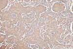 TRPV3 Antibody in Immunohistochemistry (Paraffin) (IHC (P))