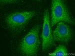 IREB2 Antibody in Immunocytochemistry (ICC/IF)