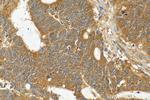 IREB2 Antibody in Immunohistochemistry (Paraffin) (IHC (P))