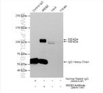 IREB2 Antibody in Immunoprecipitation (IP)