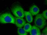 PLA2G4E Antibody in Immunocytochemistry (ICC/IF)