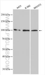 PLA2G4E Antibody in Western Blot (WB)