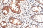 MYO5B Antibody in Immunohistochemistry (Paraffin) (IHC (P))