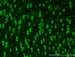 IL3RA/CD123 Antibody in Immunohistochemistry (PFA fixed) (IHC (PFA))