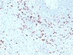 Granzyme B (NK/T-Cell Lymphoma Marker) Antibody in Immunohistochemistry (Paraffin) (IHC (P))