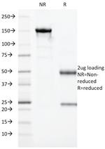 Granzyme B (NK/T-Cell Lymphoma Marker) Antibody in SDS-PAGE (SDS-PAGE)