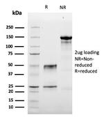 Granzyme B Antibody in SDS-PAGE (SDS-PAGE)