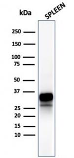Granzyme B (NK/T-Cell Lymphoma Marker) Antibody in Western Blot (WB)