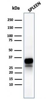 Granzyme B (NK/T-Cell Lymphoma Marker) Antibody in Western Blot (WB)