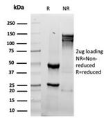 Granzyme B (NK/T-Cell Lymphoma Marker) Antibody in SDS-PAGE (SDS-PAGE)