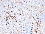 Granzyme B (NK/T-Cell Lymphoma Marker) Antibody in Immunohistochemistry (Paraffin) (IHC (P))