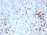 Granzyme B (NK/T-Cell Lymphoma Marker) Antibody in Immunohistochemistry (Paraffin) (IHC (P))
