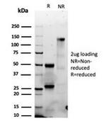 Granzyme B (NK/T-Cell Lymphoma Marker) Antibody in SDS-PAGE (SDS-PAGE)