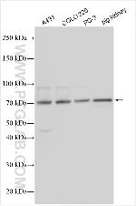 DAB2IP Antibody in Western Blot (WB)